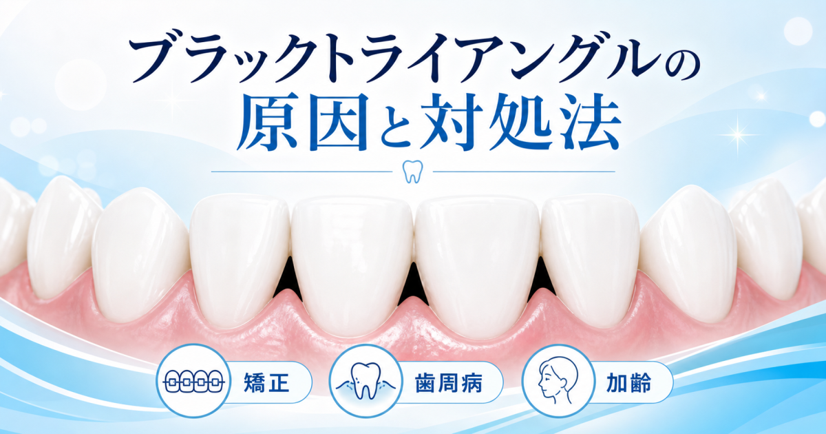 矯正後に歯の黒い隙間が目立つ？　ブラックトライアングルの原因と対処法